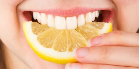 Gengive infiammate? Dall’alimentazione un aiuto concreto!